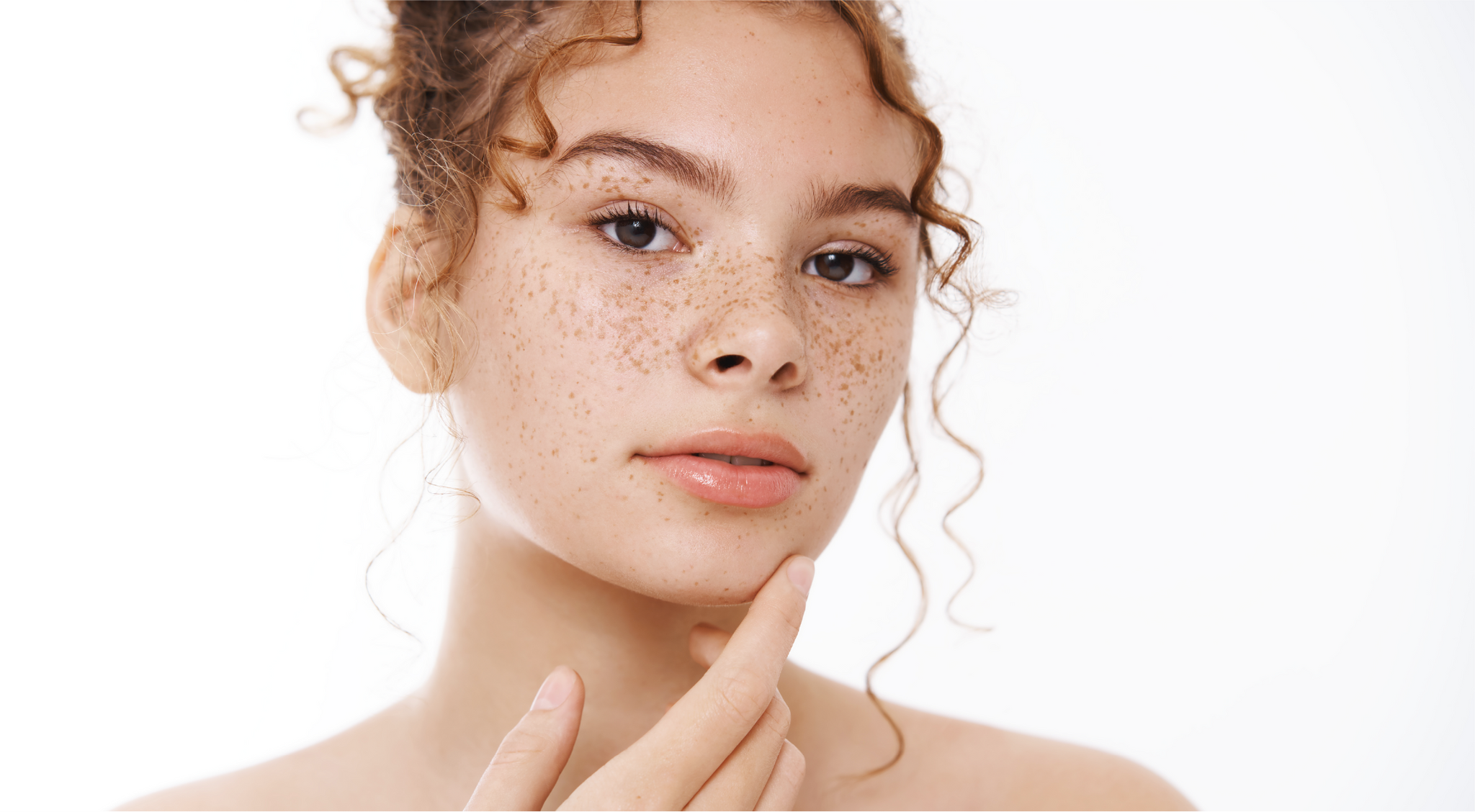 How to Pop Acne, Safely